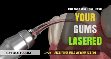 Laser Gum Treatment Cost: What to Expect for Your Oral Health