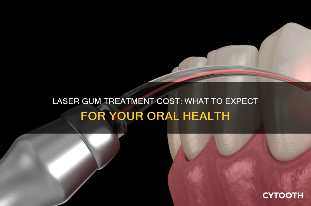 how much does it cost to get your gums lasered