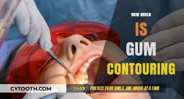 Gum Contouring Cost Guide: What to Expect for Your Smile Makeover