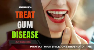 Cost of Gum Disease Treatment: What to Expect and Budget For