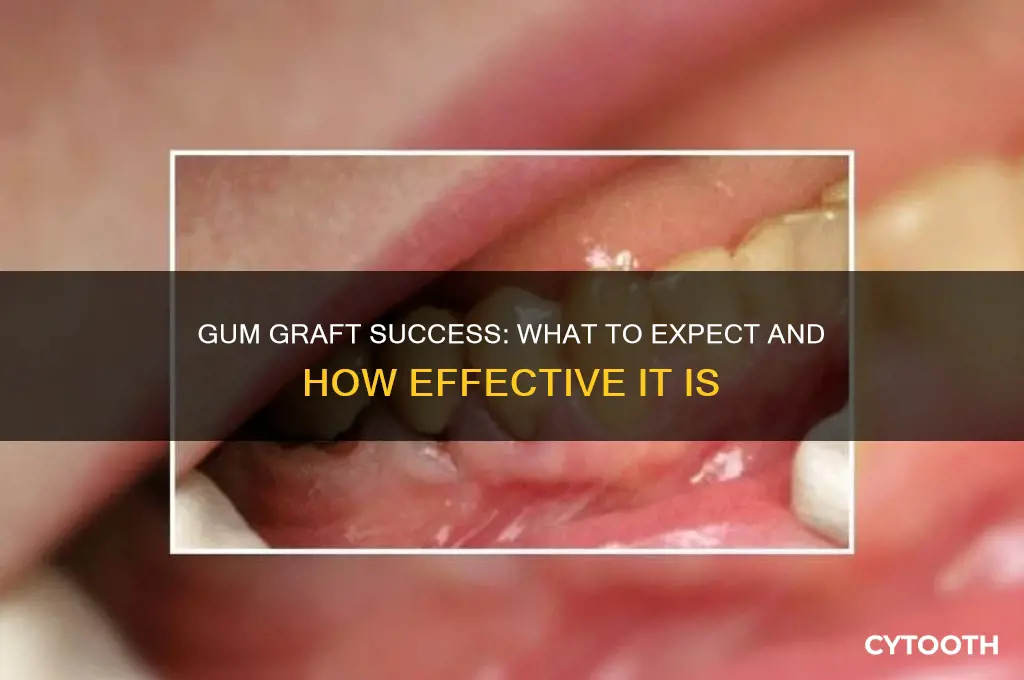 how successful are gum grafts