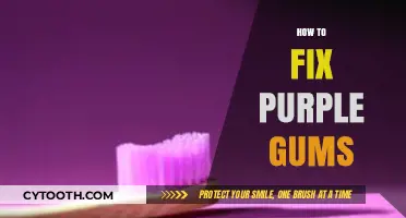Purple Gums: Causes, Concerns, and Effective Remedies for Healthy Gums