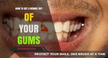 Effective Ways to Safely Remove a Kernel Stuck in Your Gums