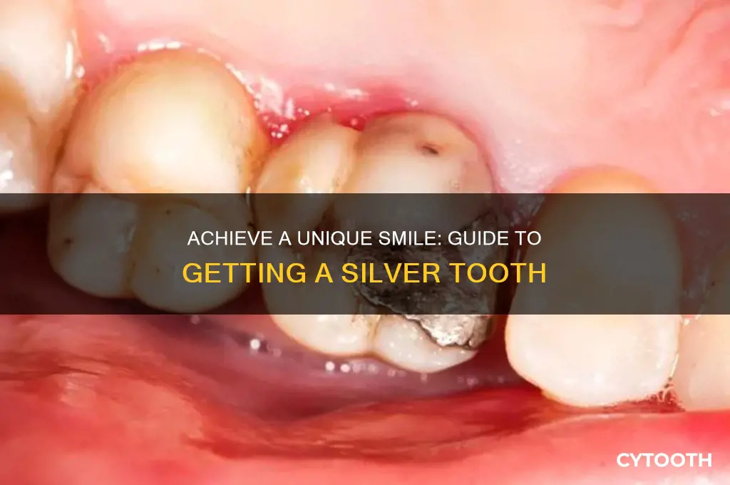 how to get a silver tooth