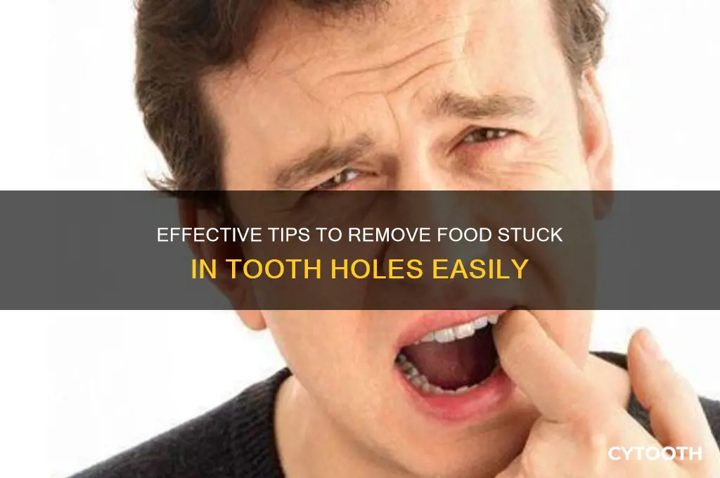 how to get food out of tooth hole