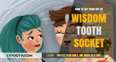 Effective Tips to Safely Remove Food from Wisdom Tooth Socket