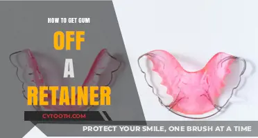 Quick Tips to Remove Chewing Gum from Your Retainer Easily
