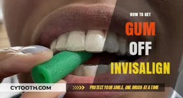Effective Tips to Remove Gum from Invisalign Aligners Easily