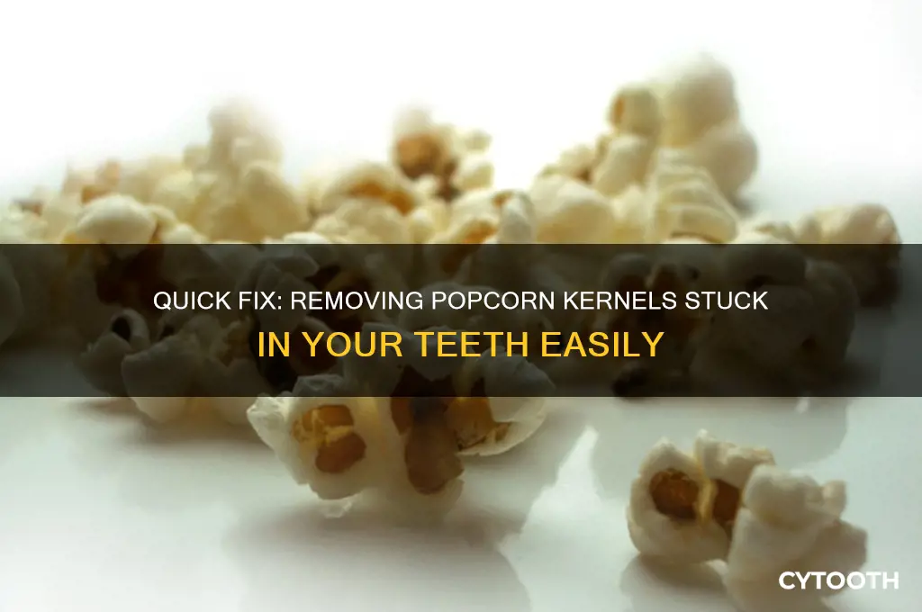 how to get popcorn kernel out of tooth