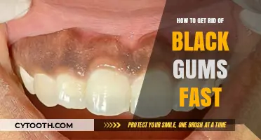 Quick Solutions for Black Gums: Restore Your Gum Health Fast