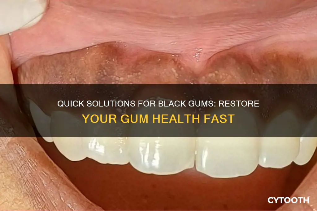 how to get rid of black gums fast