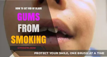 Restore Healthy Gums: Effective Ways to Reverse Smoking-Induced Black Gums
