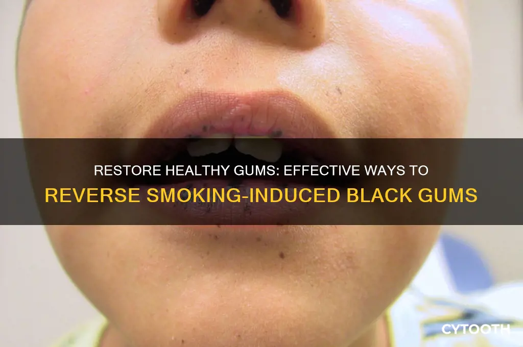 how to get rid of black gums from smoking