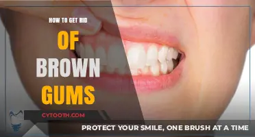 Effective Ways to Restore Pink Gums and Eliminate Brown Discoloration