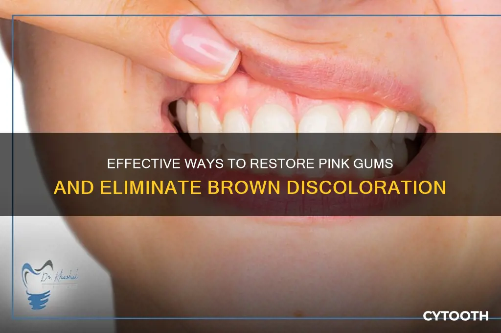 how to get rid of brown gums