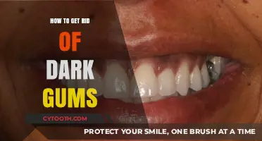 Effective Ways to Brighten Dark Gums and Restore Your Smile