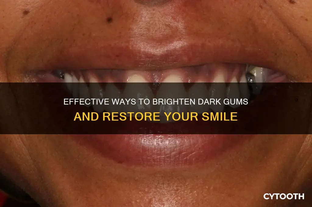 how to get rid of dark gums