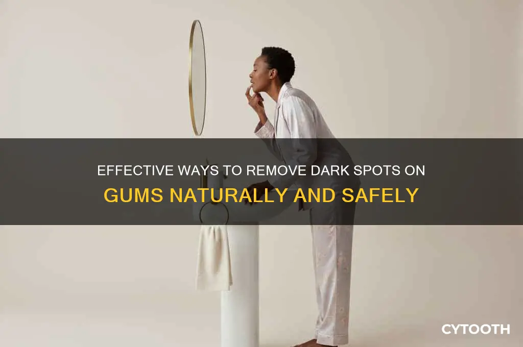 how to get rid of dark spots on gums