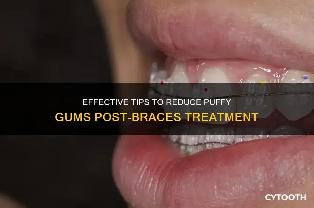 how to get rid of puffy gums after braces