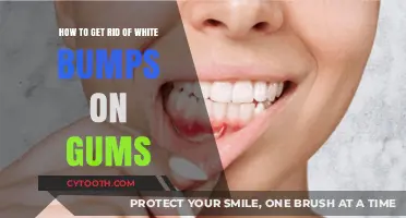 Effective Ways to Eliminate White Bumps on Your Gums