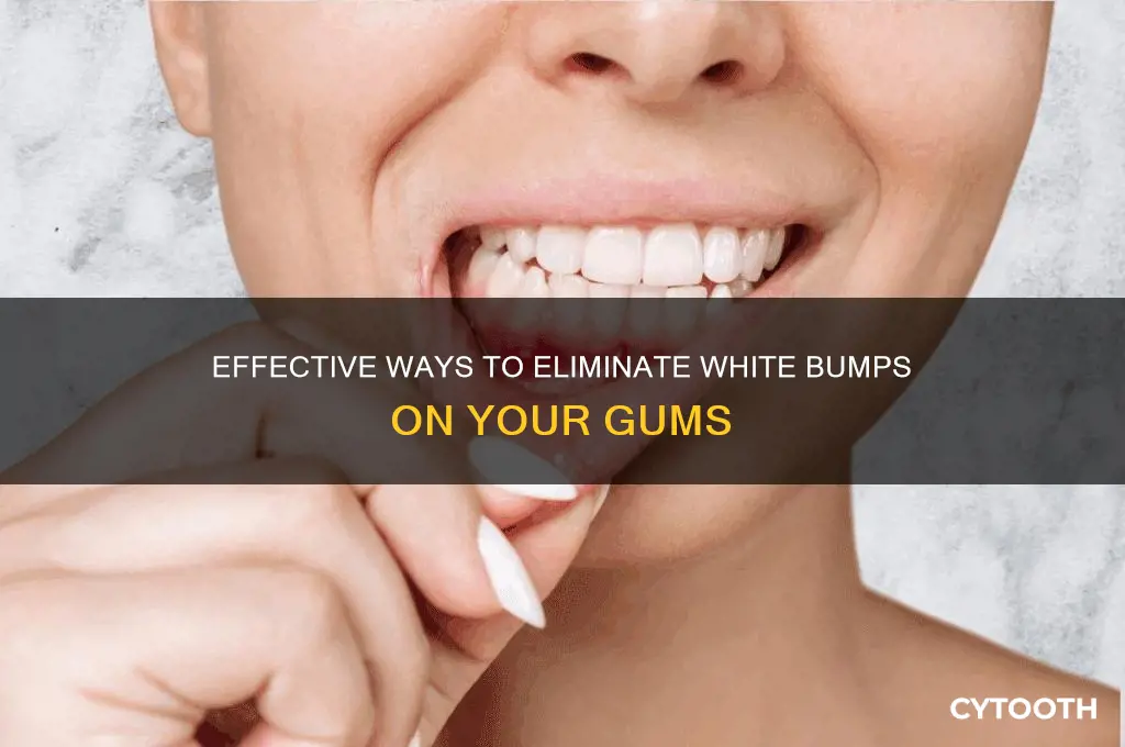 how to get rid of white bumps on gums