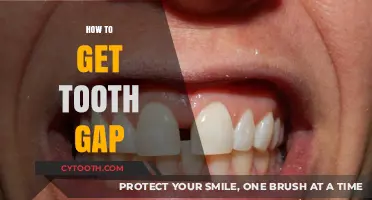 Achieve a Perfect Tooth Gap: Simple Steps for a Unique Smile