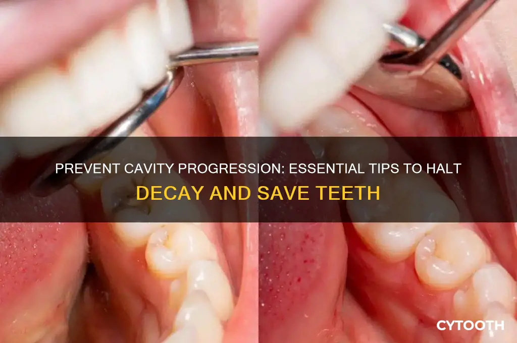 how to keep a cavity from getting worse