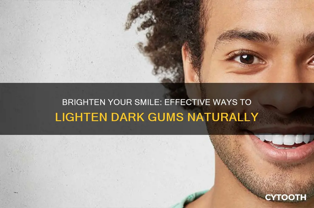 how to lighten your gums