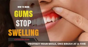 Effective Remedies to Reduce Swollen Gums and Promote Oral Health