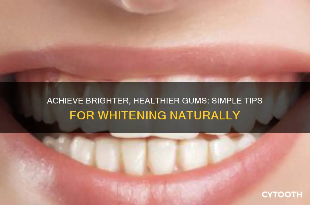 how to make gums white