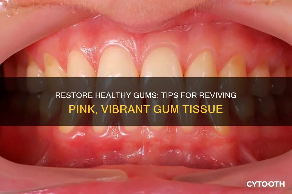 how to make my gums pink again
