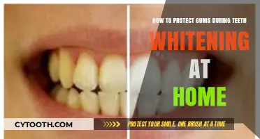 Safeguard Your Gums: Effective Tips for At-Home Teeth Whitening