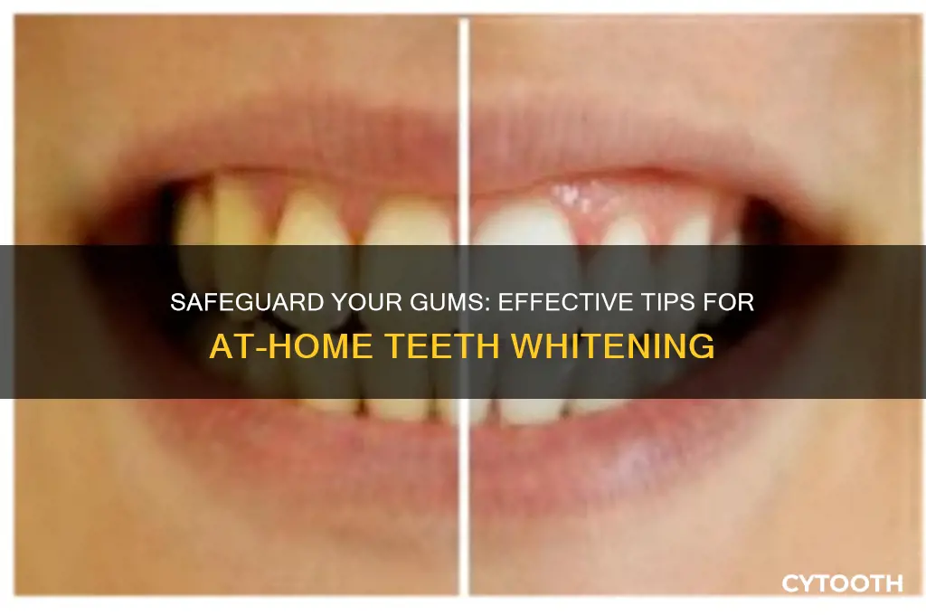 how to protect gums during teeth whitening at home