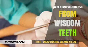 Effective Ways to Reduce Gum Swelling from Wisdom Teeth
