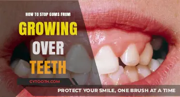 Prevent Gum Overgrowth: Effective Tips to Save Your Teeth