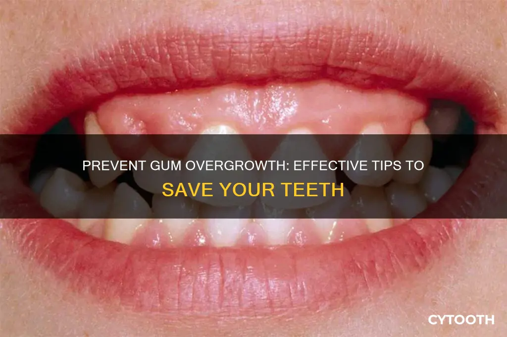 how to stop gums from growing over teeth
