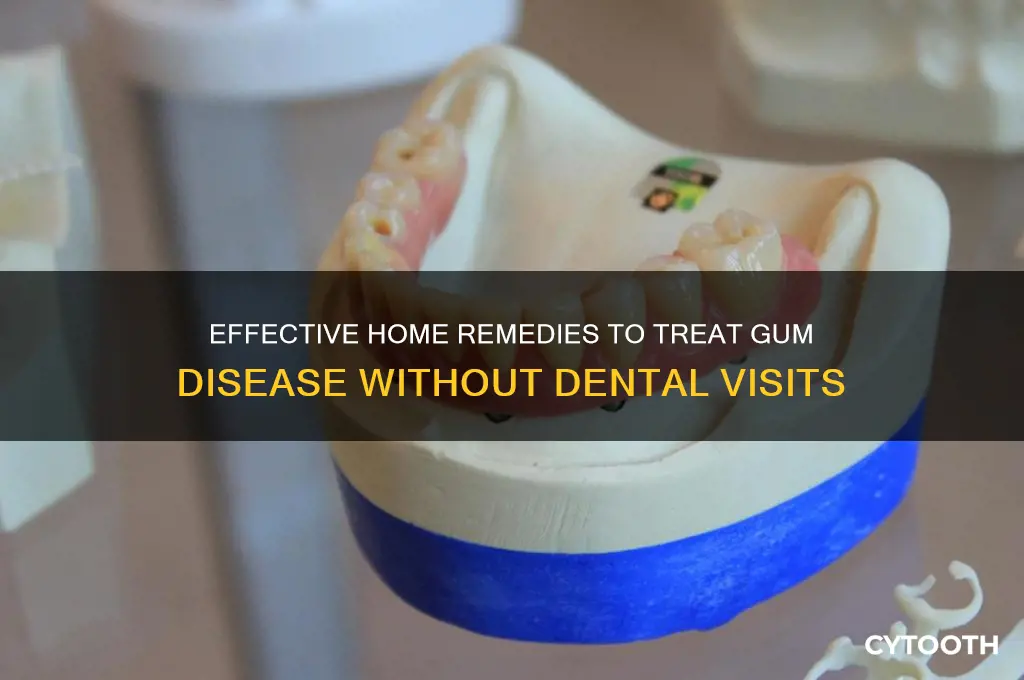 how to treat gum disease without a dentist