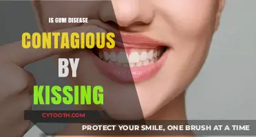 Can Kissing Spread Gum Disease? Facts and Prevention Tips