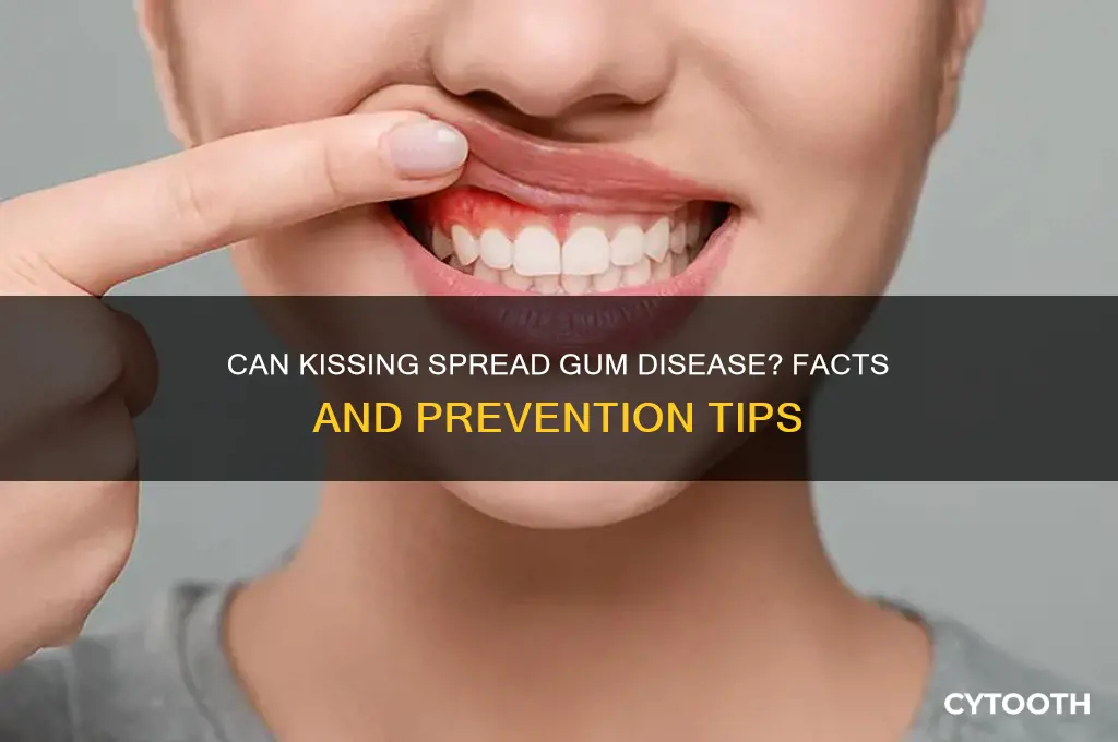 is gum disease contagious by kissing