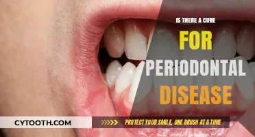 Can Periodontal Disease Be Cured? Exploring Treatment Options and Prevention