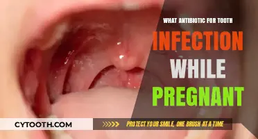 Safe Antibiotic Options for Treating Tooth Infections During Pregnancy