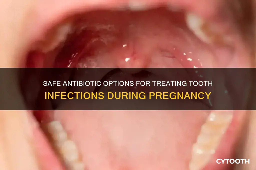 what antibiotic for tooth infection while pregnant
