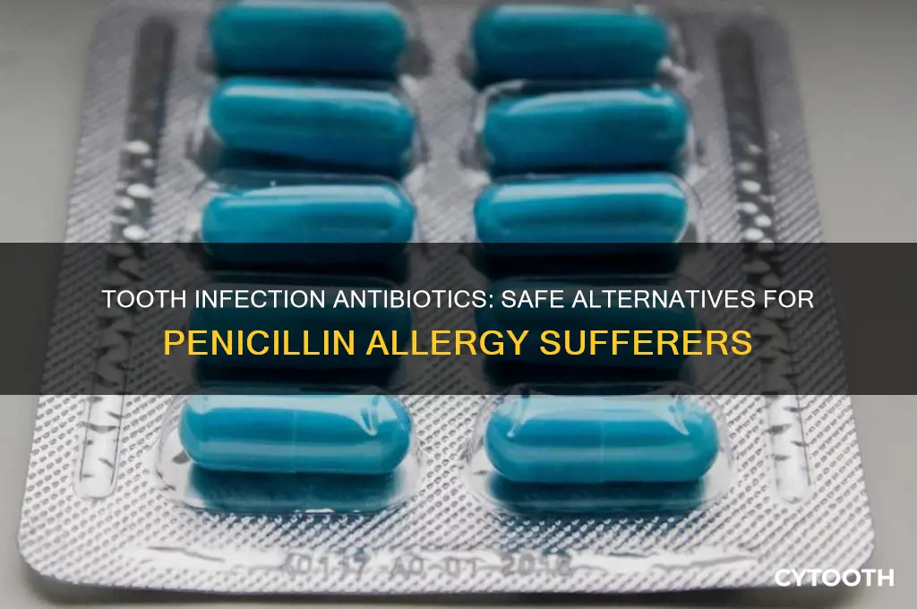 what antibiotic is used for tooth infection allergic to penicillin