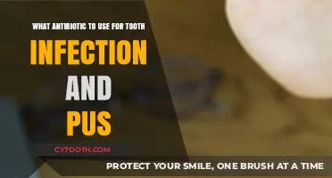 Effective Antibiotics for Treating Tooth Infections with Pus: A Guide