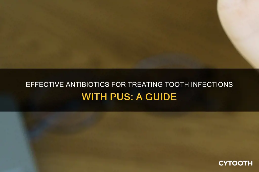 what antibiotic to use for tooth infection and pus
