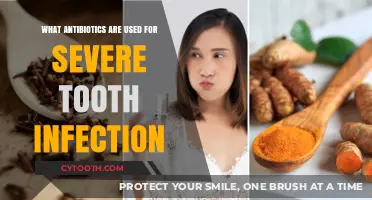 Effective Antibiotics for Treating Severe Tooth Infections: A Comprehensive Guide
