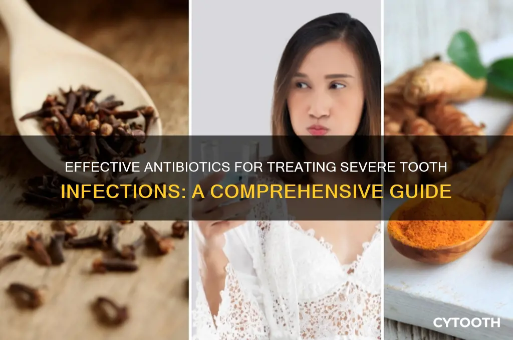 what antibiotics are used for severe tooth infection