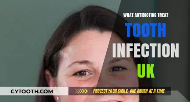 Effective UK Antibiotics for Treating Tooth Infections: A Comprehensive Guide