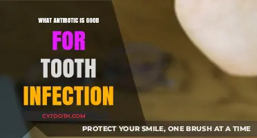 Effective Antibiotics for Treating Tooth Infections: A Comprehensive Guide