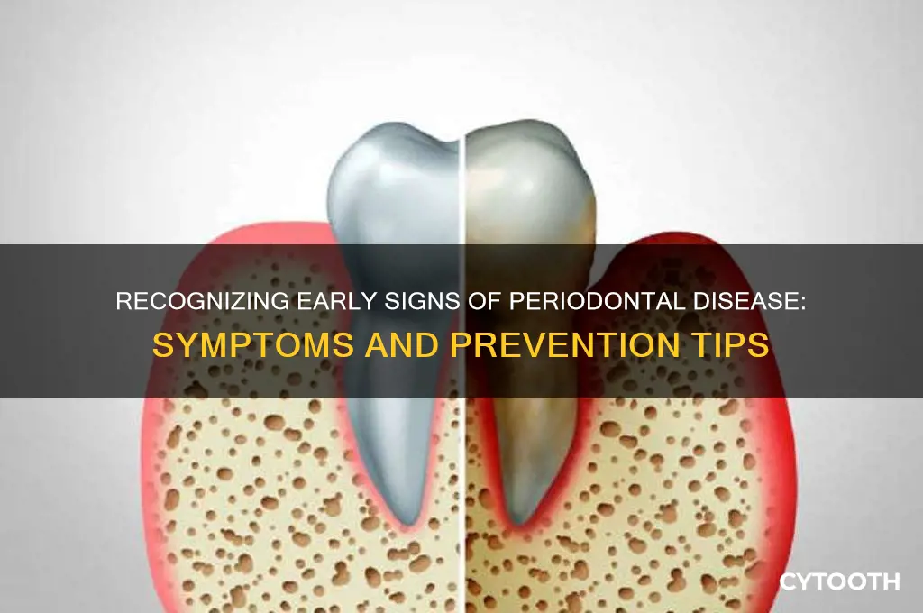 what are the signs of periodontal disease